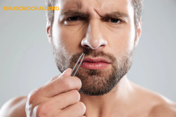 Nhổ râu có liên quan đến rối loạn nội tiết không?
