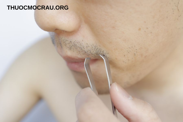 Nhổ râu có mọc lại