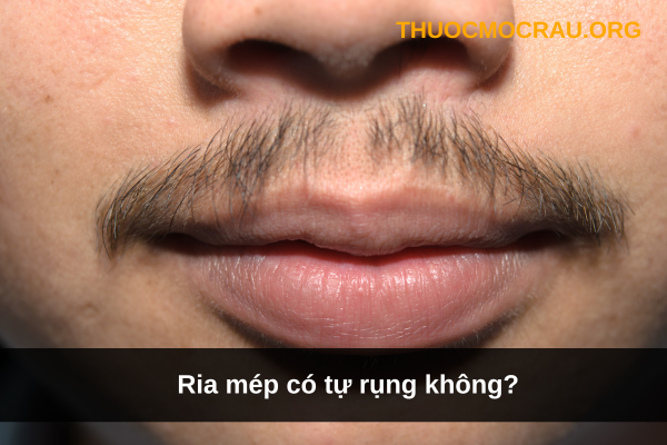 Ria mép có tự rụng không?
