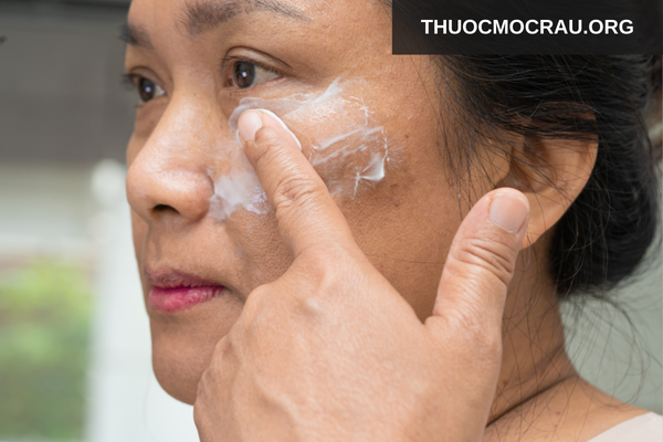 Kem trị nám có thành phần đặc trị mạnh