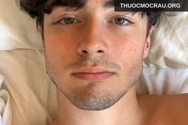 Râu lởm chởm nam tính (Stubble Beard)