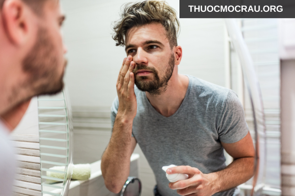 Thoa kem dưỡng ẩm phù hợp