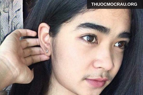 Yếu tố di truyền