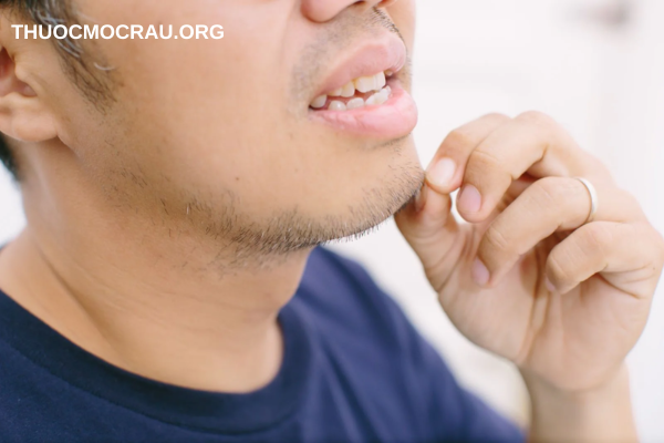 Lời khuyên: Nên hạn chế nhổ râu thường xuyên